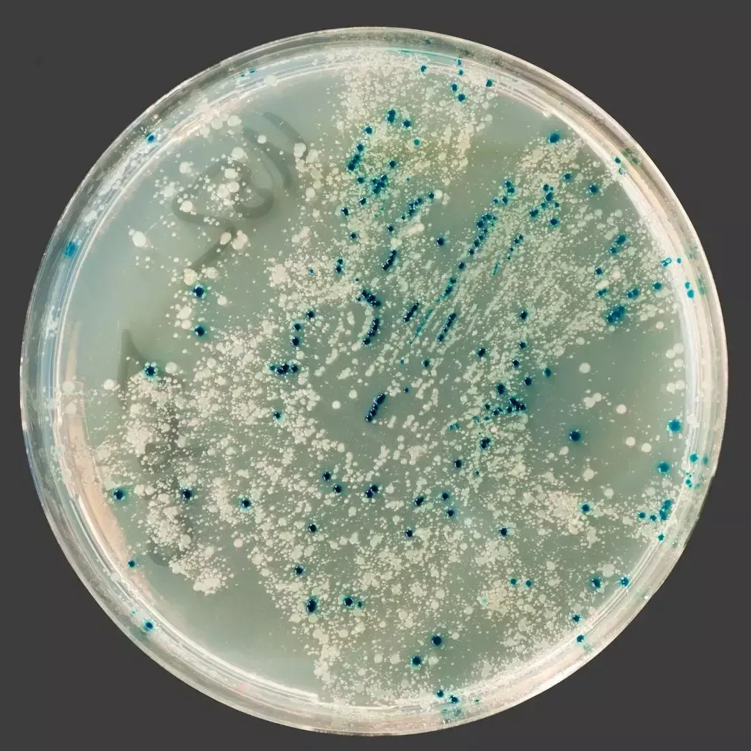 Petri dish culture plate showing mold and bacteria colonies from a surface sample
